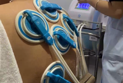 TTS動力溫控經(jīng)皮給藥治療：無創(chuàng)無痛，提升患者治療體驗(yàn)